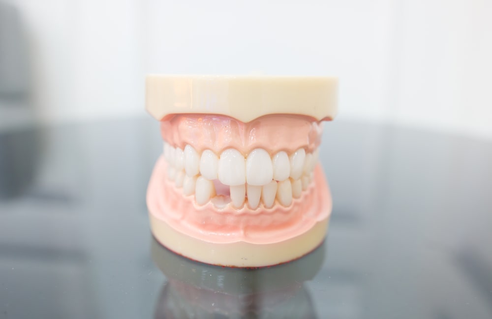 Model of tooth loss in adults