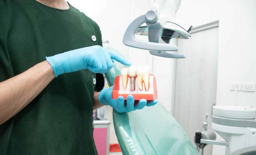 Un dentiste montre des implants dentaires