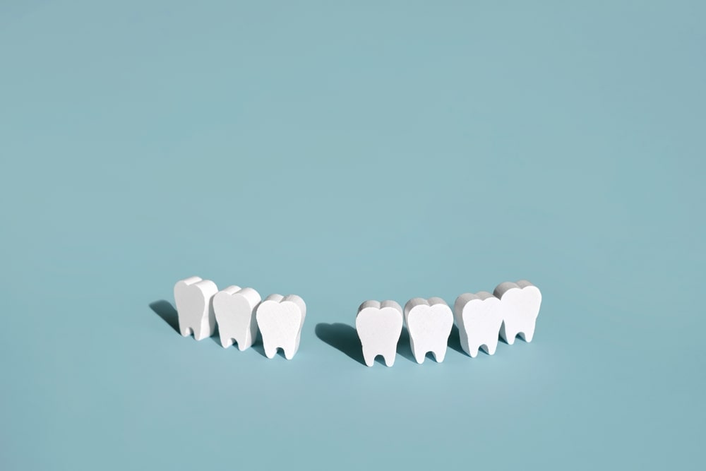 Les dents manquantes sont une situation qui peut engendrer des complications