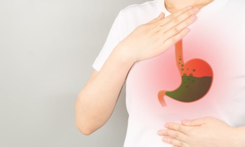 Concept représentant le reflux gastrique chez une femme